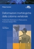 Deformazioni Morfologiche della Colonna Vertebrale