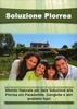 Soluzione Piorrea